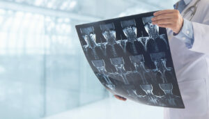 A surgeon checks a cervical spine x-ray and CT scan at an urgent care center.